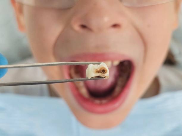 Best Same-Day Emergency Dentist in Lake Of The Pines, CA